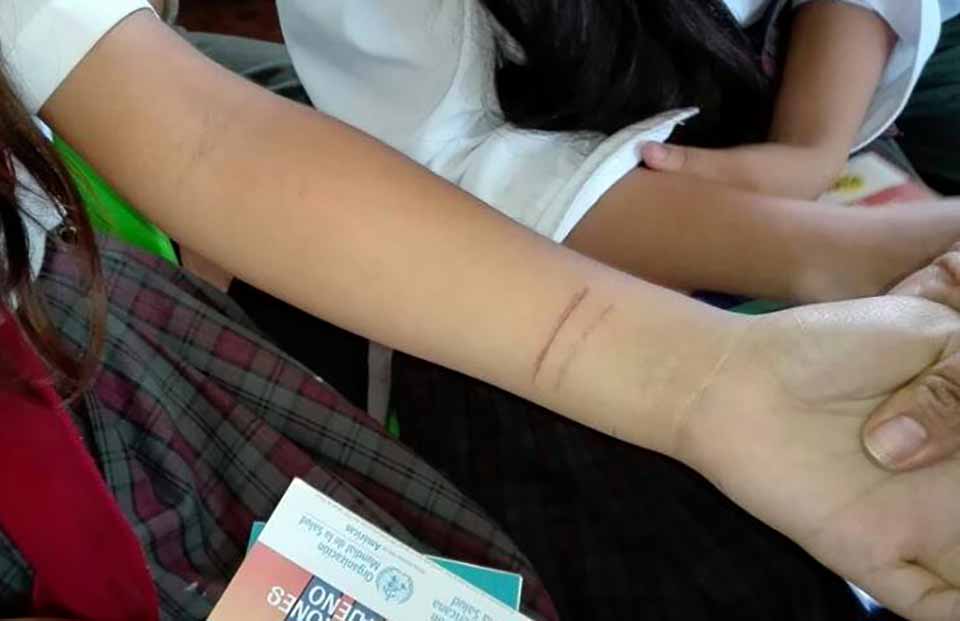 autolesion escolares