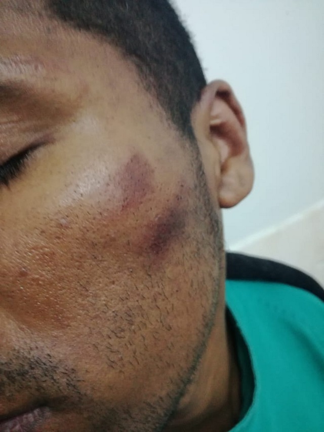 Persona denunció haber sido agredido por policías de Talara