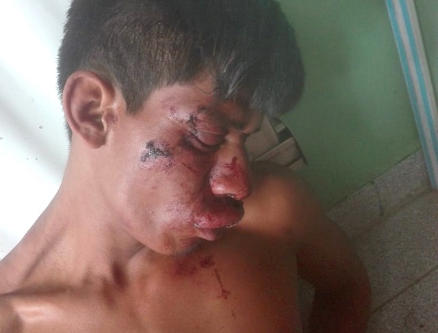 Ladronzuelo se salvó de ser quemado en Talara