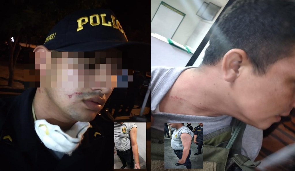 Agresiones causadas a efectivos policiales por detenidos