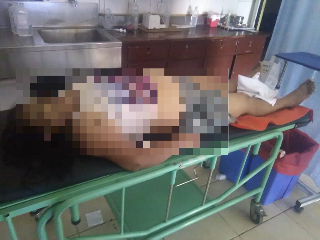 Mujer muere Talara