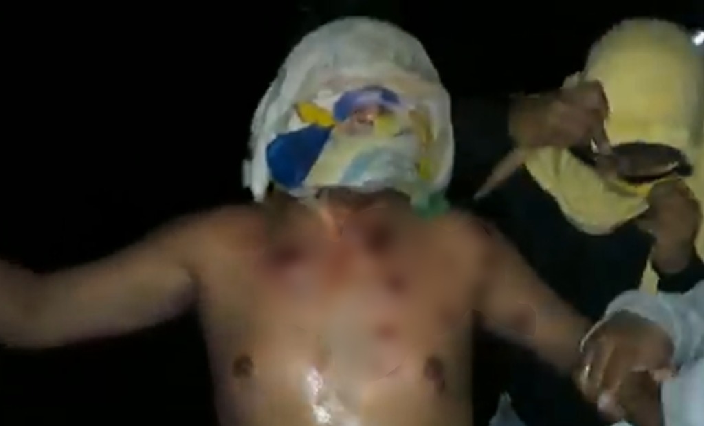 Herido penal Rio Seco