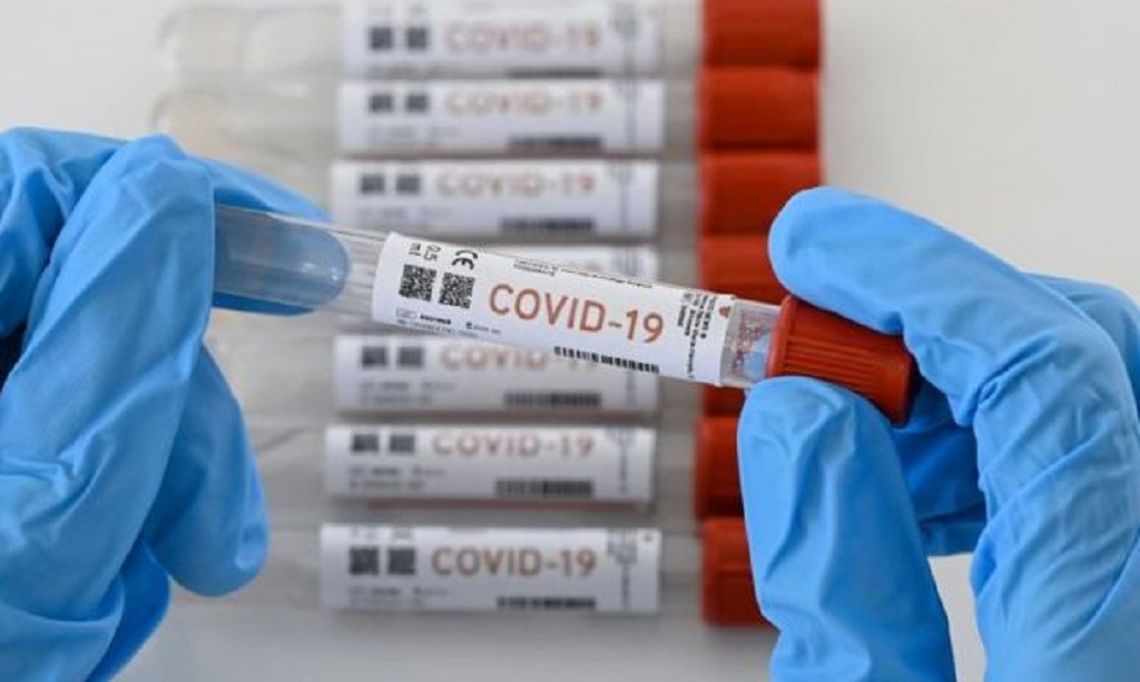 Casos confirmados por coronavirus Covid-19 ascienden a 330,123 en el Perú