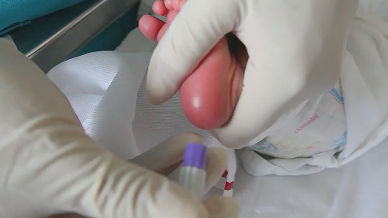 Tamizaje neonatos 2